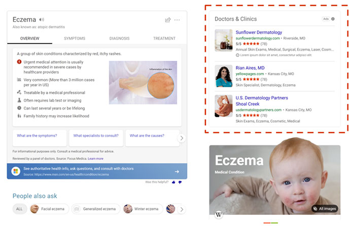 A vertical ad depiction about eczema in a web page.